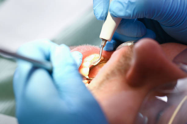 Best Walk-In Emergency Dentist in Bloomingdale, FL